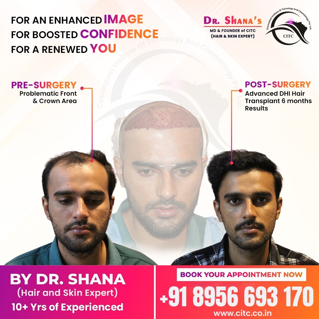 Pune's Best Hair Transplant Clinic