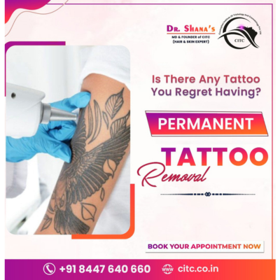 laser tattoo removal in pune