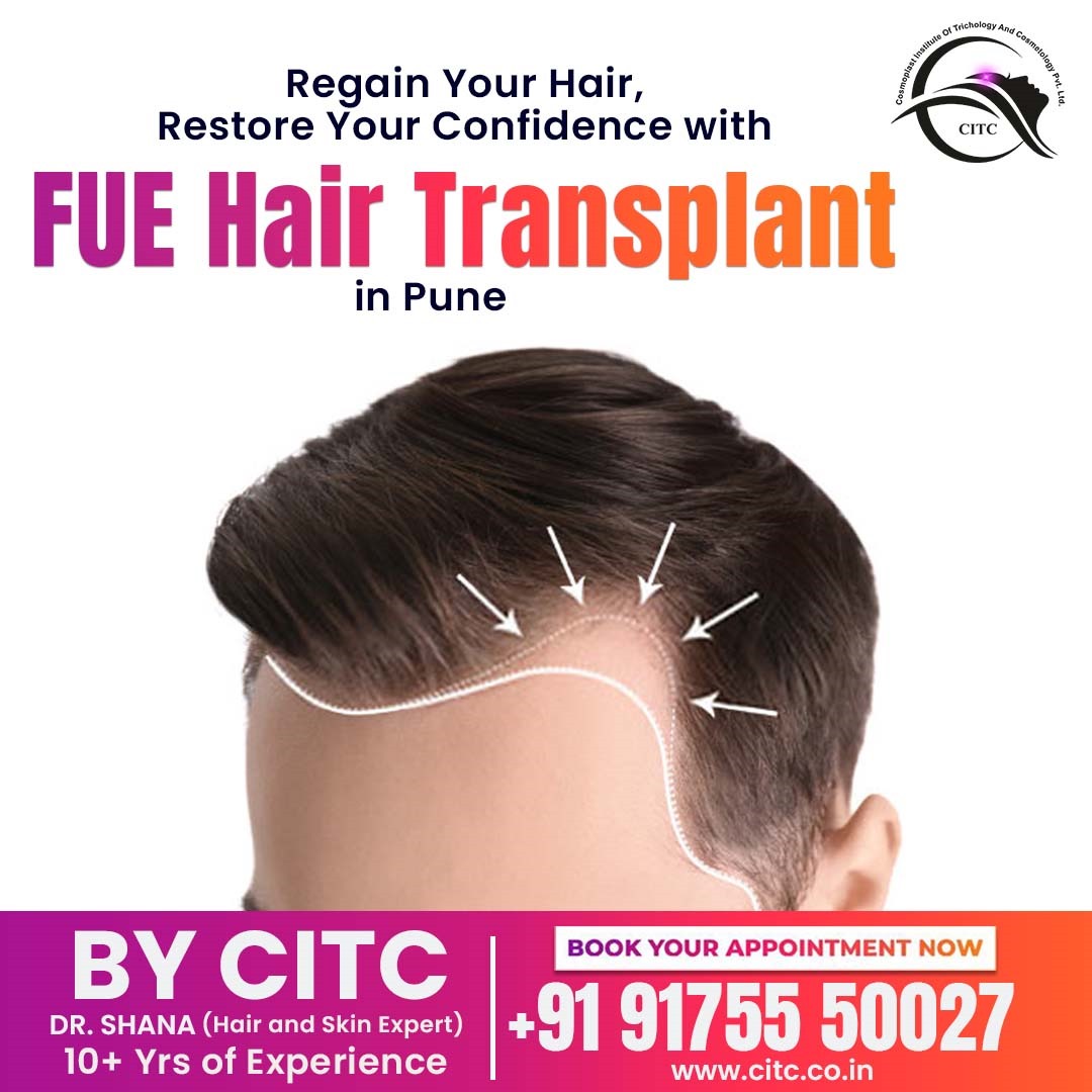 FUE Hair Transplant Treatment in Pune