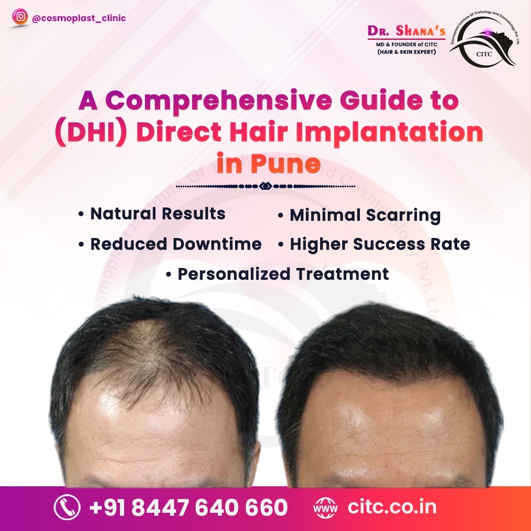 Understanding DHI Hair Transplant