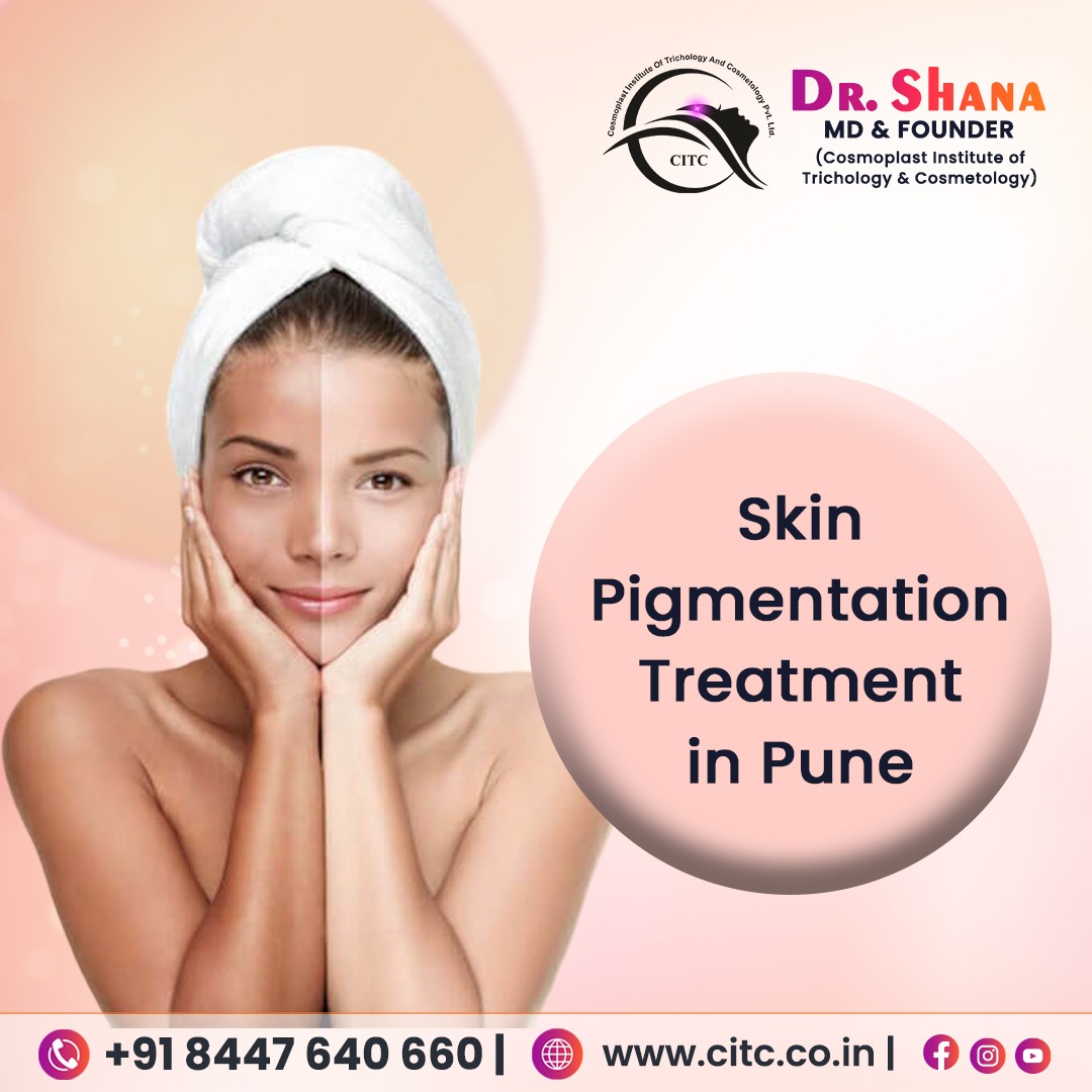Top Skin Pigmentation Treatments in Pune