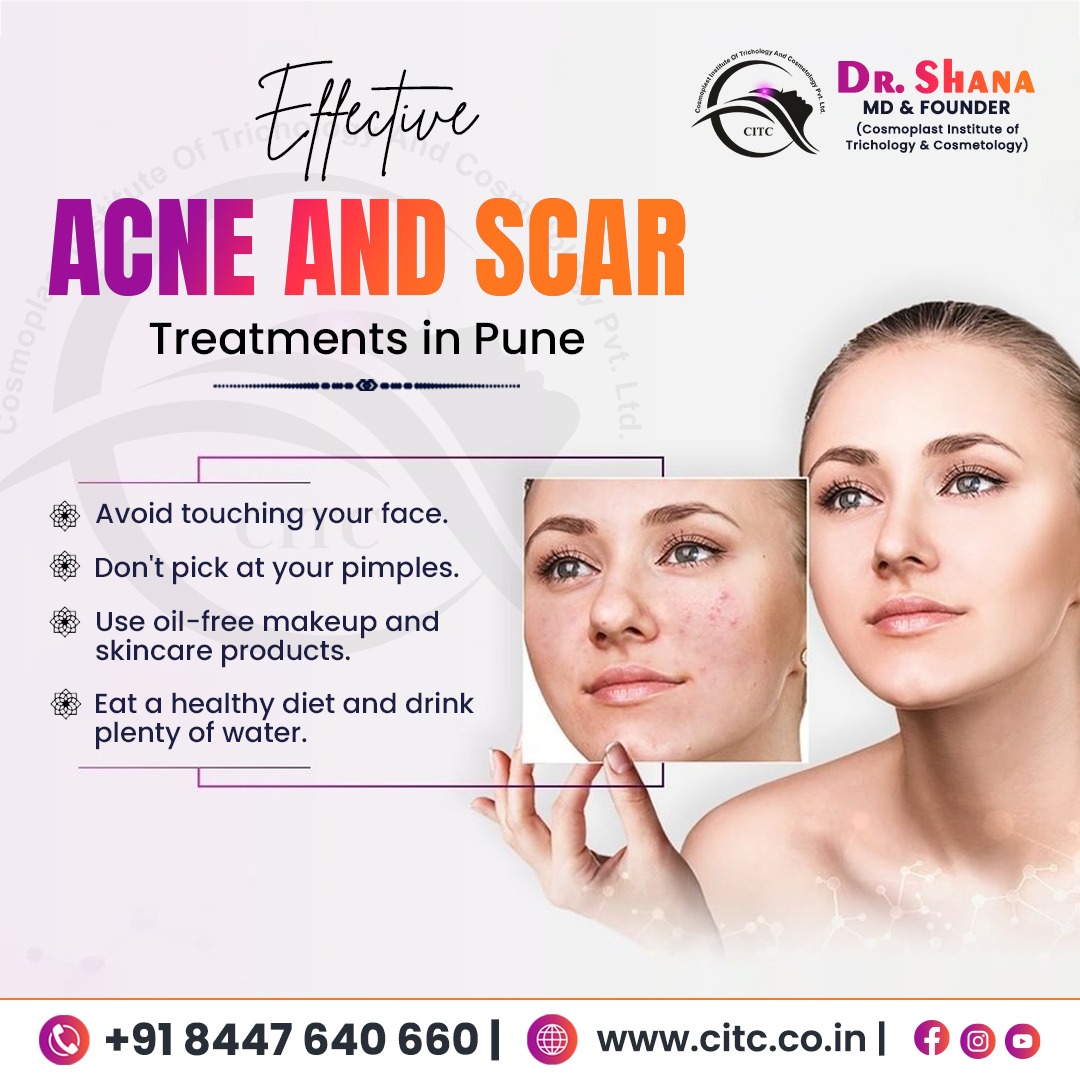 Effective Acne and Scar Treatments in Pune: A Complete Guide