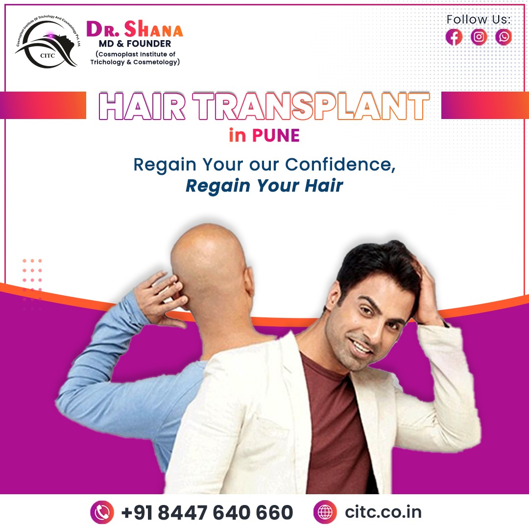 Best Hair Transplant in Pune