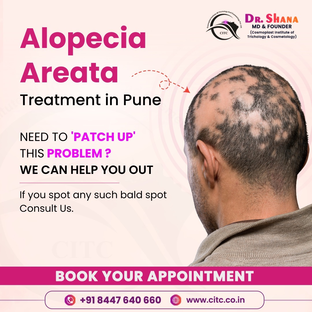 Alopecia Areata Treatment in Pune  